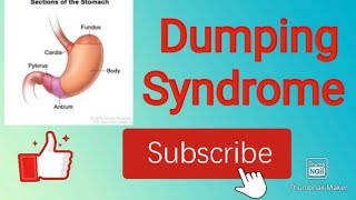 Dumping syndrome [upl. by Amliw916]