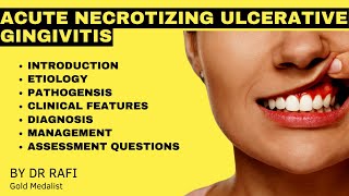 Acute Necrotizing Ulcerative Gingivitis Oral Medicine Lecture [upl. by Iren]