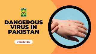 Monkey pox Virus Symptoms  Dangerous Virus In Pakistan  Lively Weekend  MasalaTV [upl. by Anaugahs]