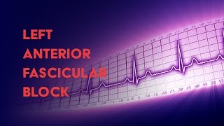 Left Anterior Fascicular Block  How to Read an Electrocardiogram EKG  MEDZCOOL [upl. by Harlie]