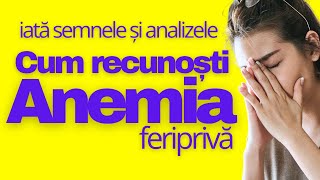 Cum recunoști ANEMIA și deficitul de fier la Femei [upl. by Chevalier458]