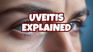 Anterior uveitis posterior uveitis and panuveitis etiology symptoms diagnosis and treatment [upl. by Cresa]