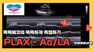 Aorta와 Left atrium diameter 측정하기PLAX echocardiography 심장초음파 심장 measure chamber size 심장크기 [upl. by Tniassuot544]