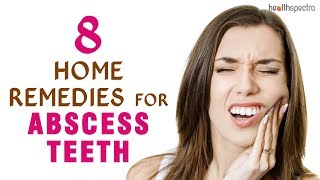 8 Home Remedies for Abscess Teeth [upl. by Mide594]