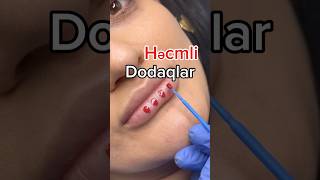 microblading keşfetteyiz bakuazerbaijan baku lips [upl. by Anolla790]