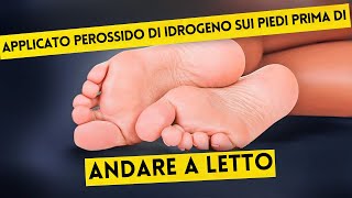 Ecco Cosa è Successo Dopo Solo 2 Volte Perossido di Idrogeno sui Piedi [upl. by Kolnos]