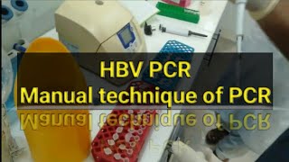 HBV PCR test PCR test Manually [upl. by Brunhilde]