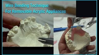 Wire Bending Technique for Removable Acrylic Appliances [upl. by Ahter]