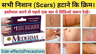 Mederma Cream  mederma for acne scars  mederma advanced scar gel review  Online Pharmacy [upl. by Assirahc]