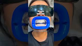 Whitening Teeth cream teeth shortvideo shortsart shorts [upl. by Daniala435]