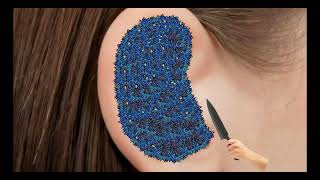 Itchy  Ear Stone Removal  Super Big Earwax  ASMR Animation TalesOfTingles [upl. by Yerrot]