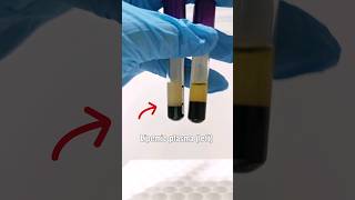 Lipemic plasma vs Normal plasma laboratory mls cls medtechstudent medtech lipemia lipoprotein [upl. by Nura]