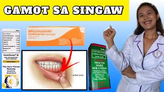 SINTOMAS DAHILAN AT GAMOT SA SINGAW SA BIBIG AT LABI  SINGAW SA BIBIG TREATMENT [upl. by Intisar]