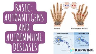 An introduction to autoimmune diseases I Autoimmunity I Immunotolerance I Antigens I Autoantigens I [upl. by Putnam]