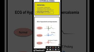 Hypercalcemia☑️hypercalcemiashortsaiimsnorcetmedicalcareerytshortsmedicalmsndisorders [upl. by Nimaj784]