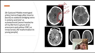 Highest yield USMLE 45 concepts in the CNS and Neuroanatomy [upl. by Eleirbag652]