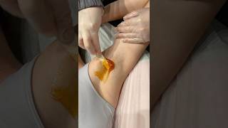 ASMR Underarm Wax On Short Hair🔎 wax asmrwax asmr asmrsounds underarmwax satisfying shorts [upl. by Echikson]