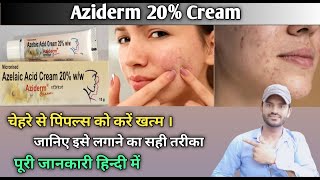 Aziderm 20 cream use benefits and side effects full review in hindi [upl. by Sitruc]