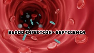 SEPSIS PATHOPHYSIOLOGY OF SEPTICEMIA [upl. by Atteugram]