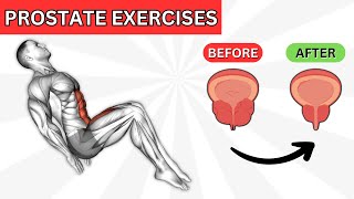 TOP 7 Kegel Exercises to SHRINK an ENLARGED PROSTATE [upl. by Garfinkel]