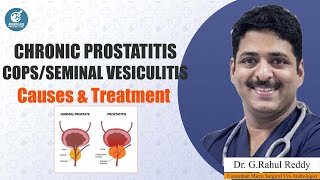 Chronic Prostatitis CopsSeminal Vesiculitis Causes amp Treatment  Rahul Reddy  Androcare Andrology [upl. by Israeli463]