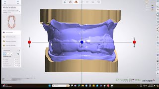 CUDCLD Design with 3D Biteplate [upl. by Llydnek65]