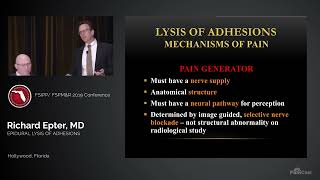 Dr Richard Epter Epidurolysis of Adhesions [upl. by Atekahs440]