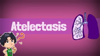 Atelectasis Causes Types amp Treatment atelectasis [upl. by Diella362]