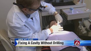 Fixing a cavity with no dental drilling [upl. by Iphagenia319]