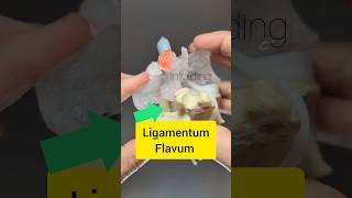 Ligamentum Flavum Modelling  Dynamic Disc Designs [upl. by Yekram]