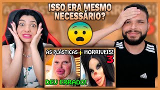 As PIORES Plásticas do Mundo As Plásticas que deram Errado PARTE 3  Fala de Tudo REACT [upl. by Oiramel]