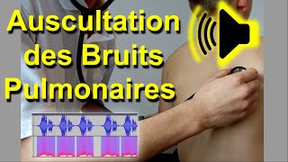 Bruits pulmonaires anormaux Auscultation Son Audio Poumon murmure vésiculaire frottement pleural [upl. by Amaty]