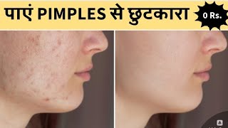 पाएं मुंहासों और पिंपल्स से छुटकारा बिना किसी खर्चे के ✨ glamgalaxy rashmi skincare viralvideo [upl. by Nnylsor]