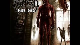 Inflicted Torture  MEATHOOK [upl. by Hasile]