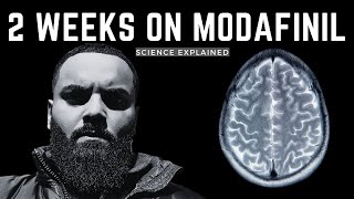 MODAFINIL EXPLAINED  2 WEEK EXPERIENCE UPDATE [upl. by Nollat]