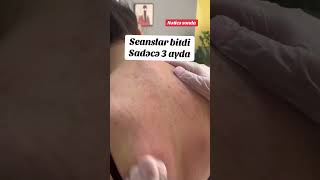 Dermatoloq dərinin dırnaqların və saçın xəstəliklərinin müalicəsi [upl. by Akinohs]