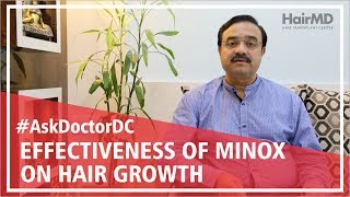 How effective is minoxidil for hair growth  HairMD Pune [upl. by Matias16]