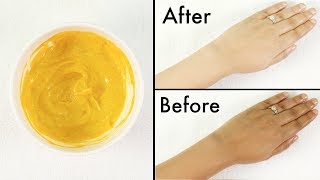 How To Remove Tan From FaceNeckHandsKnees Overnight Simple home remedie [upl. by Sayres]