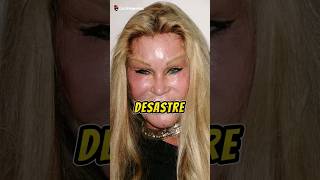 La terrible enfermedad de Jocelyn Wildenstein 😨 pelis viral movie [upl. by Nangem]