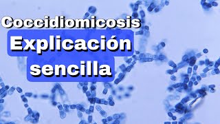 Coccidiomicosis fácil explicación [upl. by Ganiats]