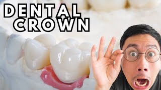 Dental Crown Procedure Animation EXPLAINED [upl. by Eaned]