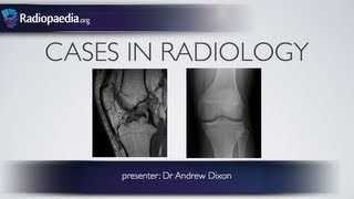 Cases in Radiology Episode 4 musculoskeletal MRI xray [upl. by Naejarual]