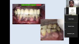 Clinical Decision Making in Prosthodontics [upl. by Niccolo]