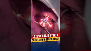 Latest Lasik Vision Correction Technology [upl. by Haleemak]