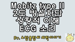 Mobitz type II second degree AV block모비츠 2형 2도 방실차단 심전도ECG 소견 [upl. by Richara]