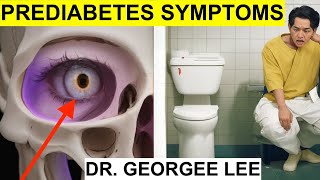 ⚡️Top 10 Prediabetes Symptoms You MUST AVOID Reverse Prediabetes [upl. by Teemus]