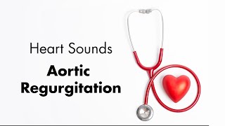 Aortic Regurgitation  Heart Sounds  MEDZCOOL [upl. by Sinnelg197]