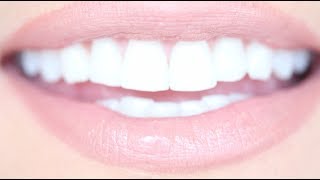 How to Get Really White Teeth For Cheap  Kandee Johnson [upl. by Naarah569]