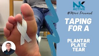 Taping for a Plantar Plate injury  tear  treatment  injuries [upl. by Kerrill108]