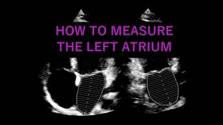 Measuring the LEFT ATRIUM VOLUME Echocardiography [upl. by Anaes]